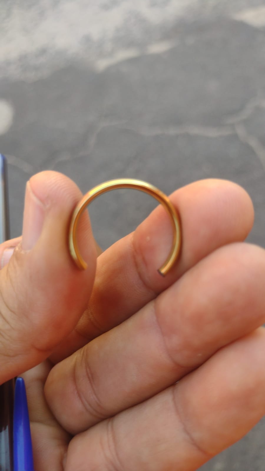 Corpo de Bombeiros retira anel preso em dedo de senhor de 36 anos de idade