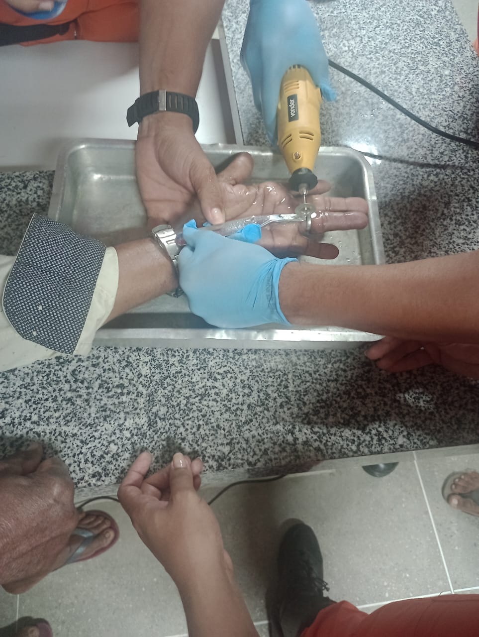 Corpo de Bombeiros retira joia presa em dedo na Cidade de Canindé