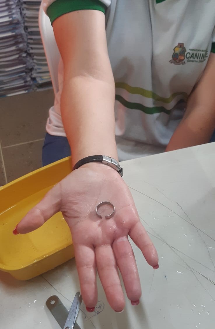 CBMCE remove joia presa de dedo de adolescente em Canindé